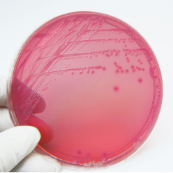 E. coli Infections: What You and Your Family Need to Know