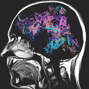 First National Conference on Leukodystrophies