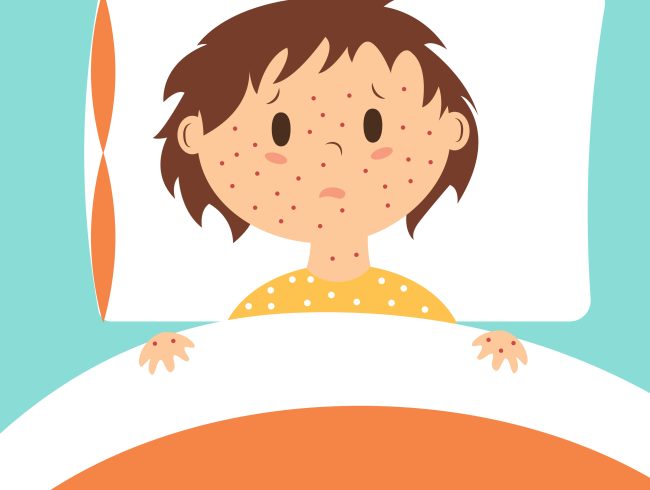 Measles: what you need to know